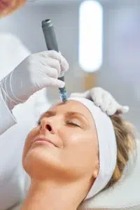 Microneedling Service in Allen, TX