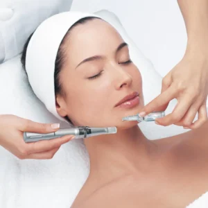 microneedling procedure